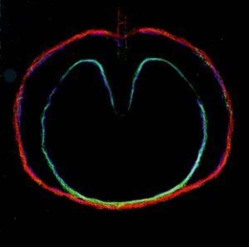 Xtc - Wasp Star: Apple Venus 2 - Image 2